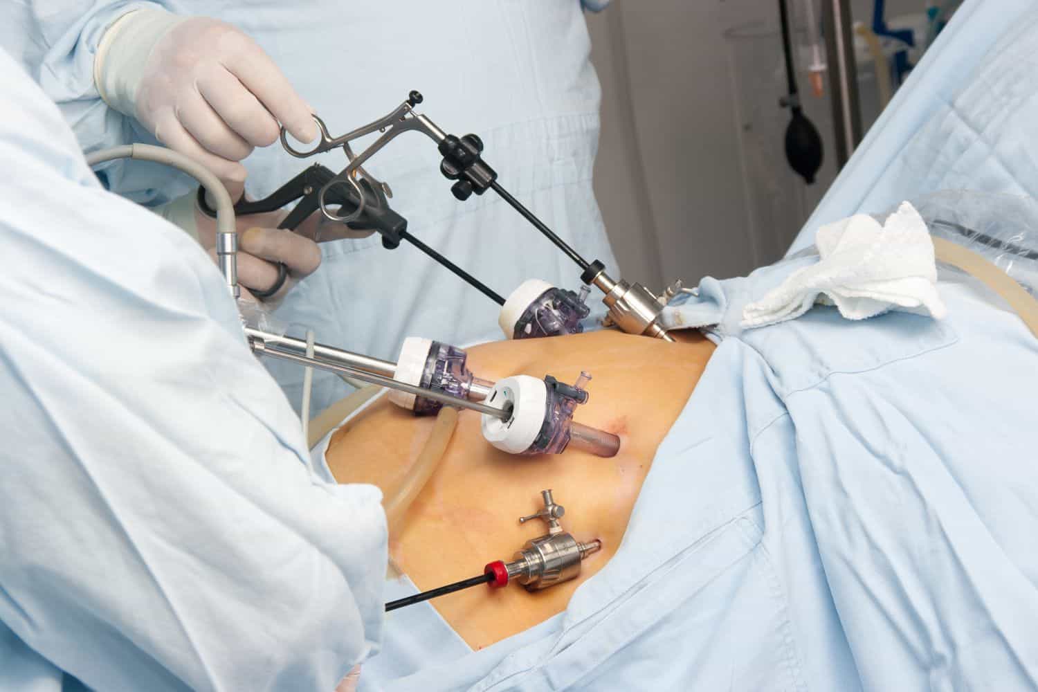 Bariatric Surgery: Is It Right for You?